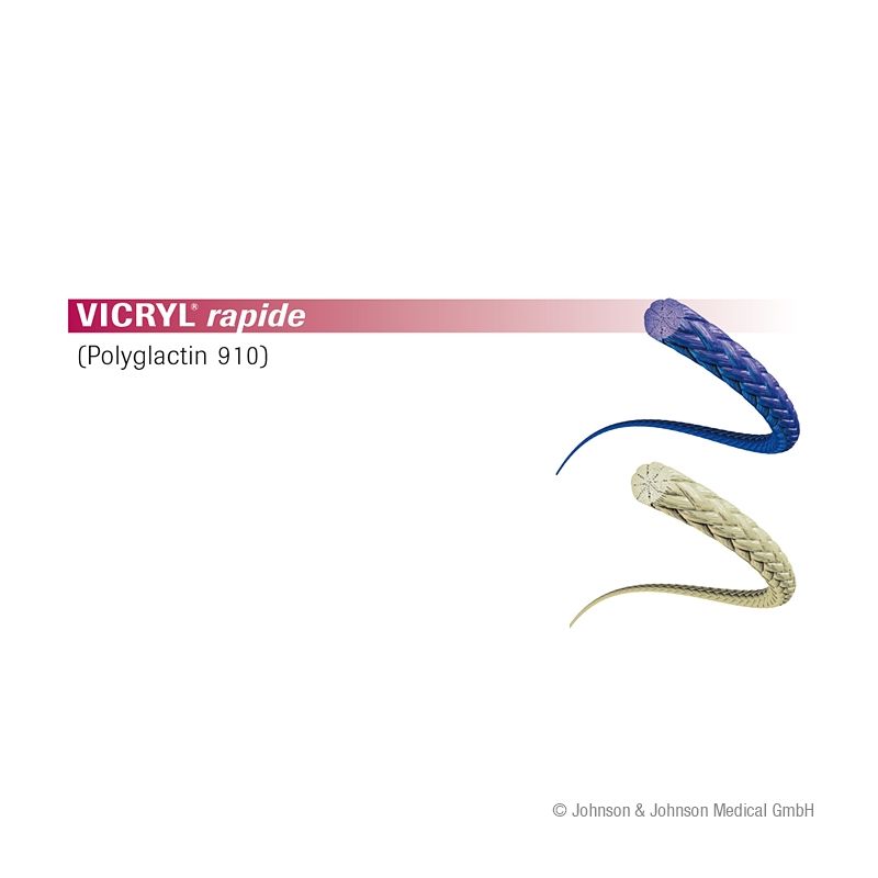 VICRYL rapide FS2 4/0=1,5 ungefärbt