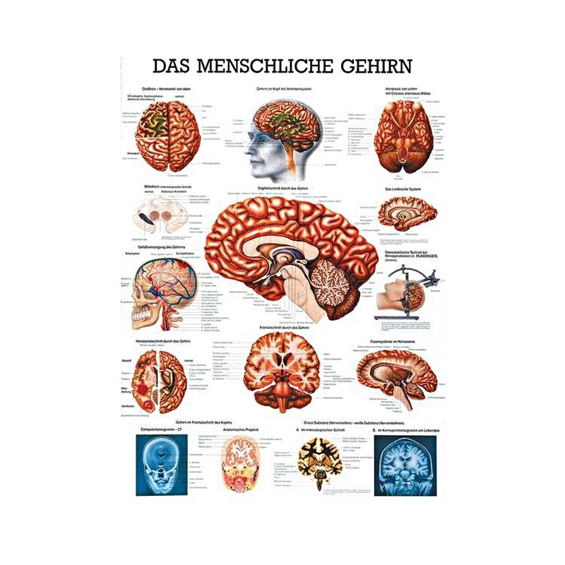 anat. Lehrtafel: Das menschliche Gehirn