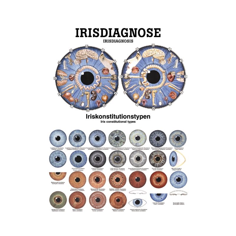anat. Poster: Irisdiagnose