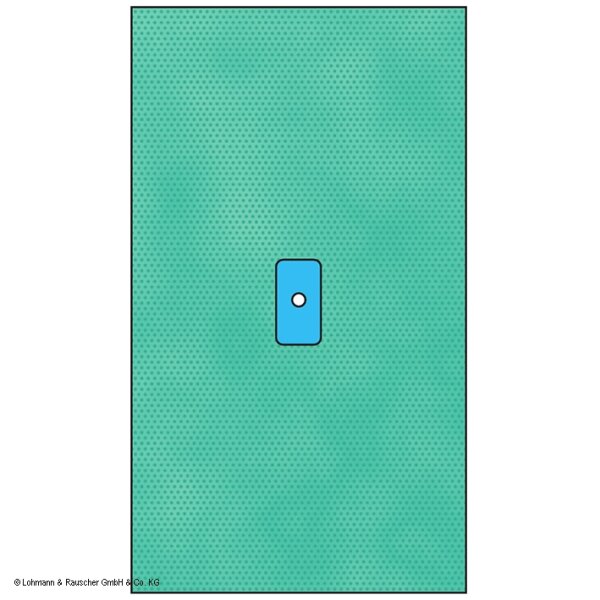 Raucodrape PRO Extremitätentücher Hand/Fuß steril, 100 x 175 cm (20 Stck.) 2-lagig