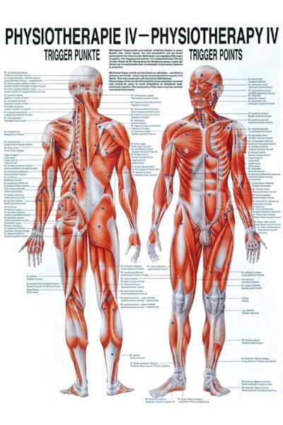 anat. Poster: Physiotherapie Triggerpunkte, 50 x 70 cm, Papier zweisprachig