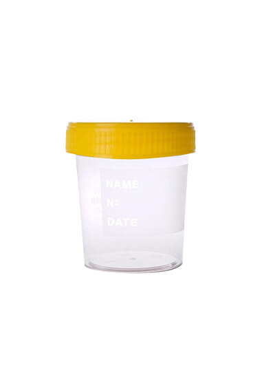 Urinbecher PP 120ml | graduiert bis 100ml | steril | gelber Deckel | 250 Stück