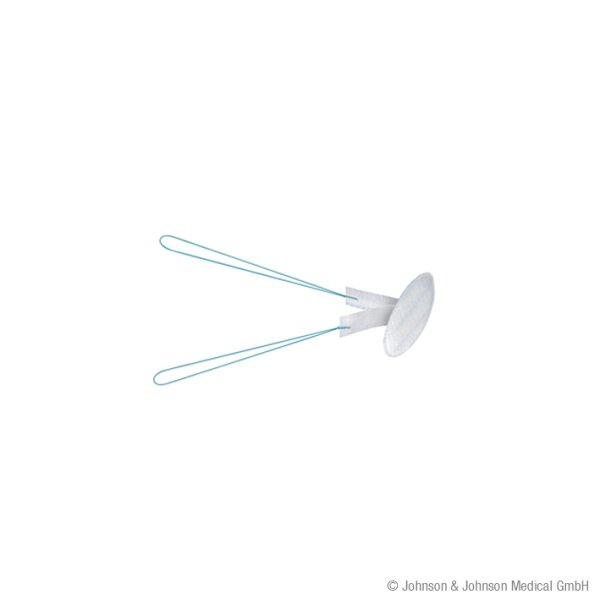 Proceed Ventral Patch Ø 4,3 cm PROLENE-PDS-ORZ (2 Stck.)